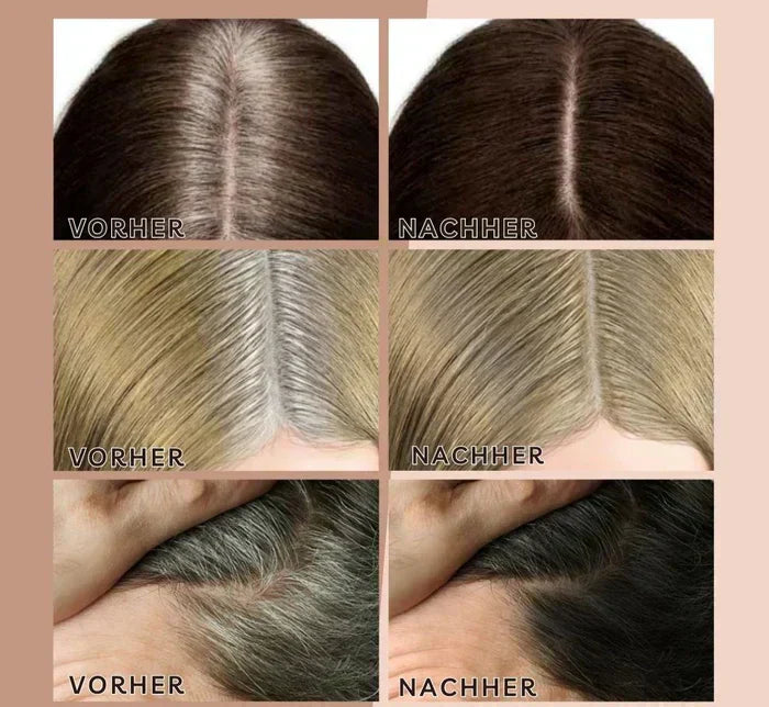 HairHalo – Perfect hairlines at any time