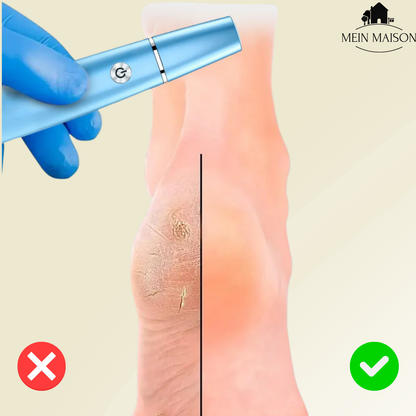 SilkaFeet™ – Effortlessly smooth and well-groomed feet