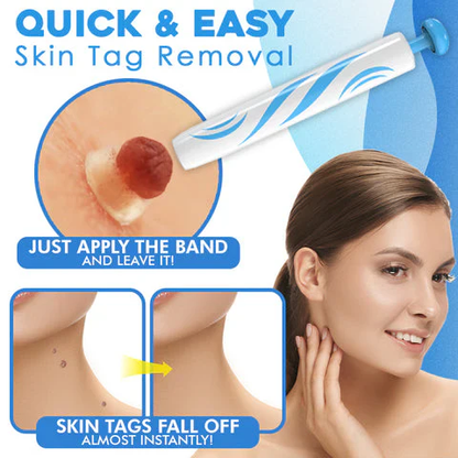 DermaClear Skin Tag Remover | Pain-Free Use | Compact & Hygienic | For Men & Women