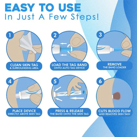 DermaClear Skin Tag Remover | Pain-Free Use | Compact & Hygienic | For Men & Women