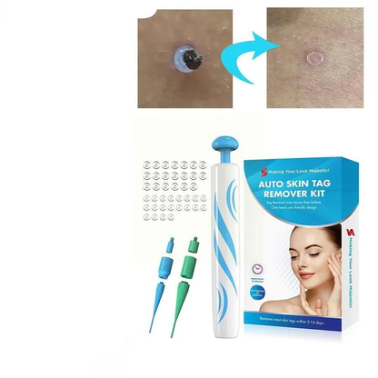DermaClear Skin Tag Remover | Pain-Free Use | Compact & Hygienic | For Men & Women