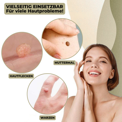 DermaLinx Wart Remover | Pain-Free Removal of Warts & Moles | For Home Use | No Surgery