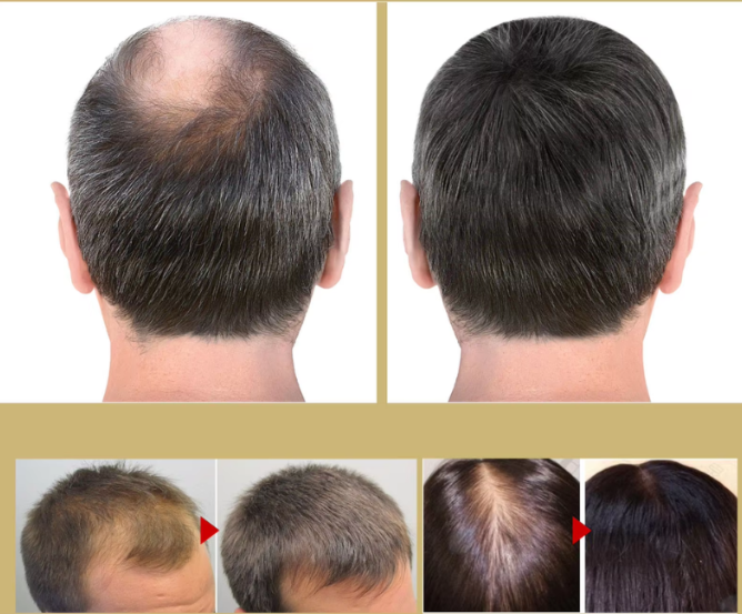 VitaStrand – Experience thicker, stronger, and healthier hair every morning