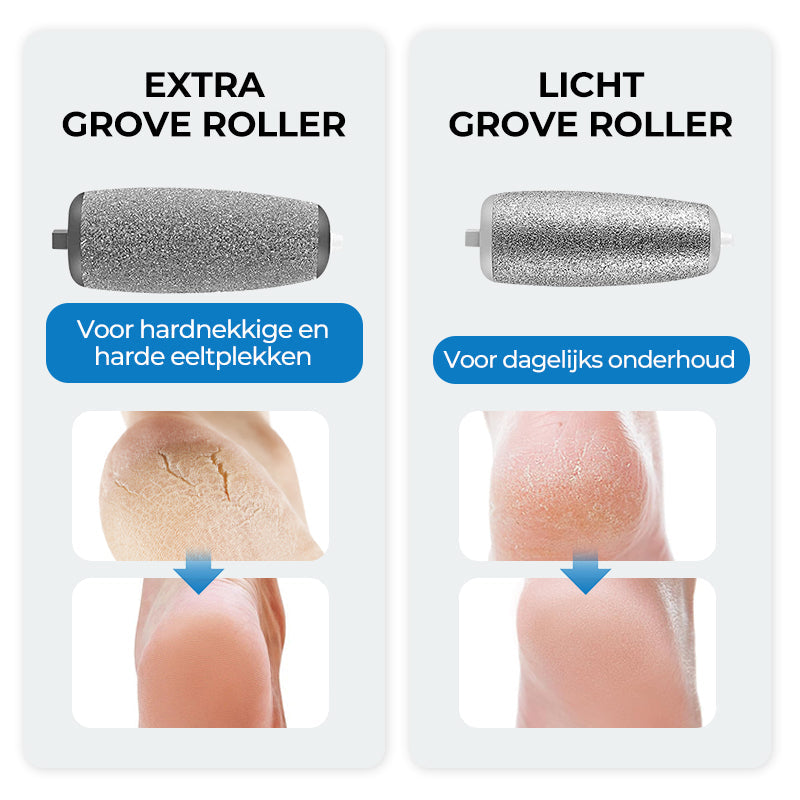 SmoothFoot – Achieve silky-smooth feet in just a few minutes