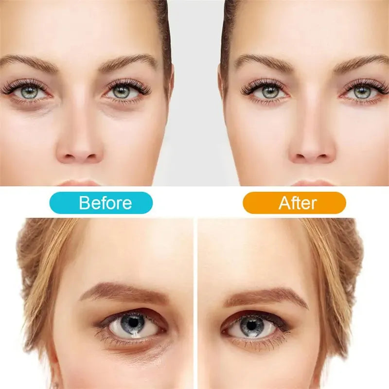 LumiVive – Remove dark spots and wrinkles for radiant, youthful skin