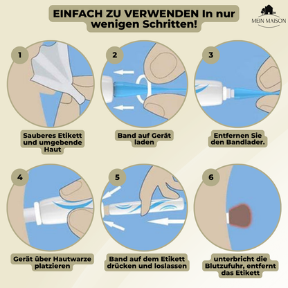 DermaLinx Wart Remover | Pain-Free Removal of Warts & Moles | For Home Use | No Surgery