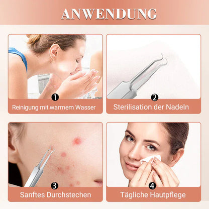 Blackhead Remover Set PureSkinX | Precise & Hygienic | Stainless Steel Tools for Clear Skin