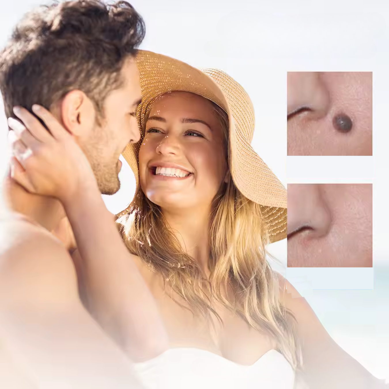 WartAway – Natural Wart Remover