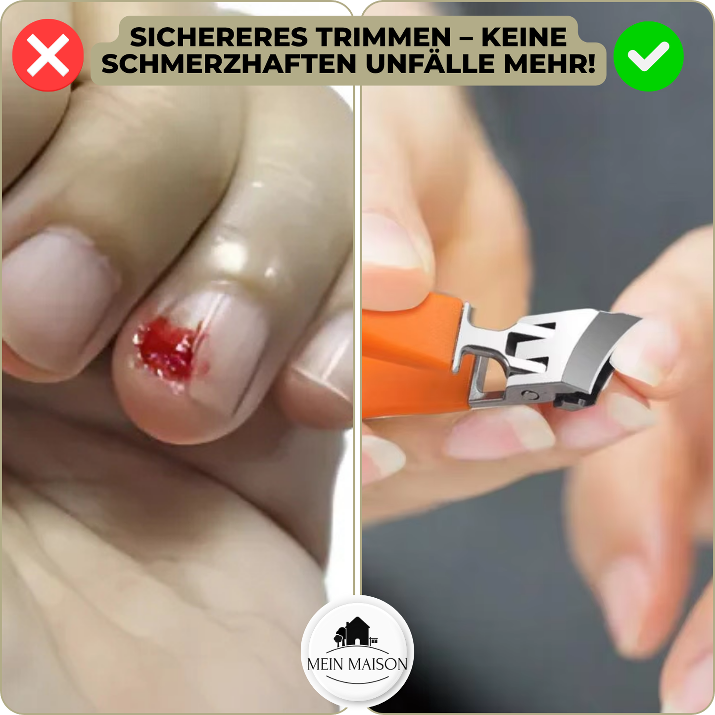 Nail Clippers WideTrim | Extra-Wide Jaw Opening | Anti-Splash Design | Stainless Steel