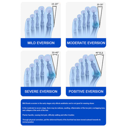 AlignEase – Pain-Free Walking Without Surgery