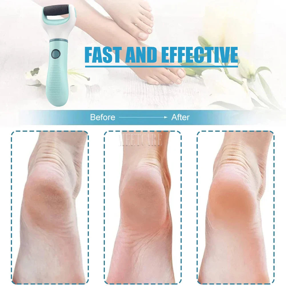 Pedivance Electric Callus Remover with USB Charging | For Gentle Foot Care & Pedicure | Removes Dry, Cracked & Callused Skin – 1200 mAh
