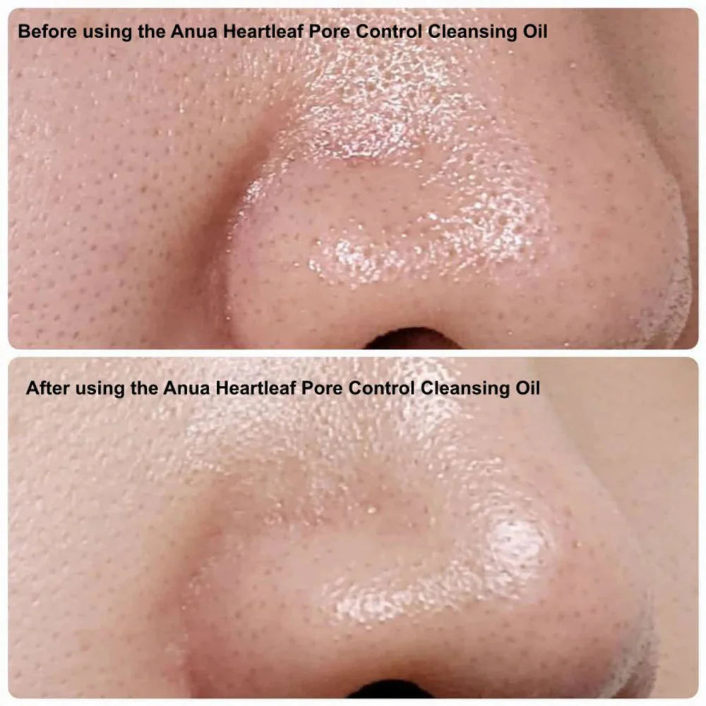 Anua - Heartleaf Pore Control Cleansing Oil Mild