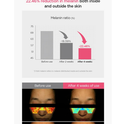 Anua - Peach 70 Niacin Serum