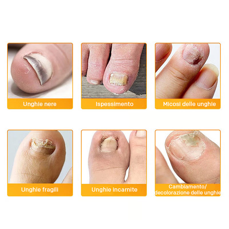 FungoStop – Repair and renew healthy nails while you sleep!