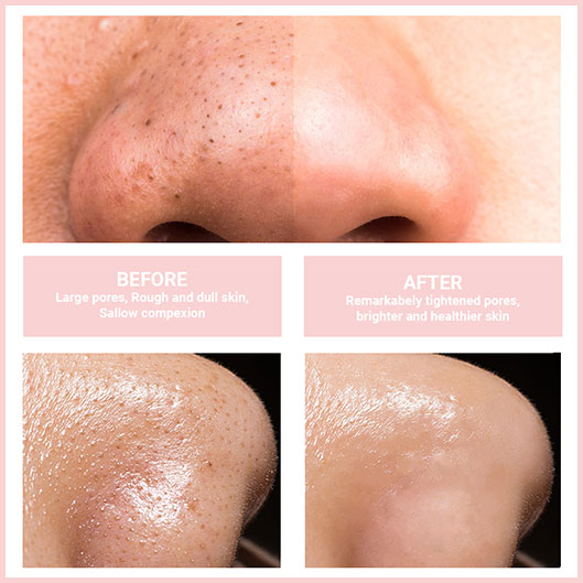 LumiDerm – Achieve instantly clear, smooth skin every day